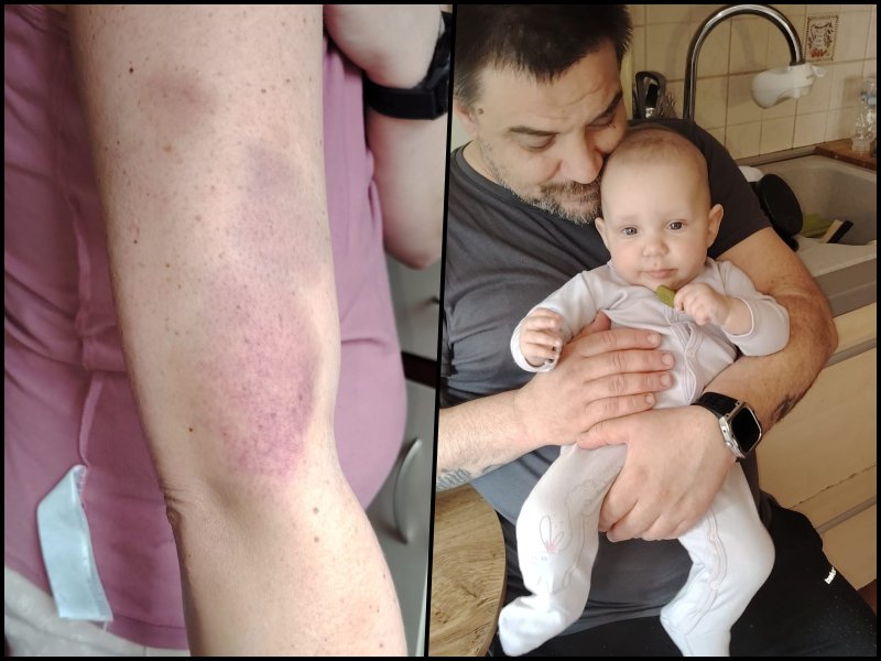 OBITELJ UJDUR U BORBI ZA ŽIVOT Bolest, siromaštvo i nada u pomoć dobrih ljudi